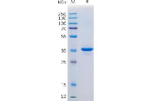 Human CD20 Protein, hFc Tag on SDS-PAGE under reducing condition. (CD20 Protein (Fc Tag))