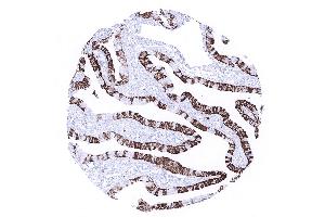 fallopian tube mucosa (Rekombinanter Cytokeratin 7 Antikörper  (AA 1-100))