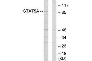 Western Blotting (WB) image for anti-Signal Transducer and Activator of Transcription 5A (STAT5A) (Internal Region) antibody (ABIN1849361) (STAT5A Antikörper  (Internal Region))