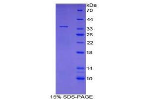 SDS-PAGE analysis of Human Topoisomerase I Protein. (Topoisomerase I Protein)