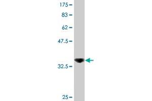 Western Blotting (WB) image for anti-DEAD (Asp-Glu-Ala-Asp) Box Polypeptide 56 (DDX56) (AA 450-547) antibody (ABIN527138)