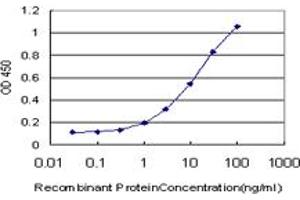 Detection limit for recombinant GST tagged LIMK1 is approximately 0. (LIM Domain Kinase 1 Antikörper  (AA 548-647))