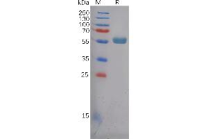 Human Protein, hFc Tag on SDS-PAGE under reducing condition. (FZD4 Protein (AA 37-180) (Fc Tag))