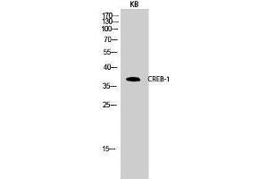 Western Blotting (WB) image for anti-cAMP Responsive Element Binding Protein 1 (CREB1) (Ser256) antibody (ABIN3174548) (CREB1 Antikörper  (Ser256))