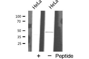 Western blot analysis of GATA6 expression in HeLa cells (GATA6 Antikörper  (Internal Region))