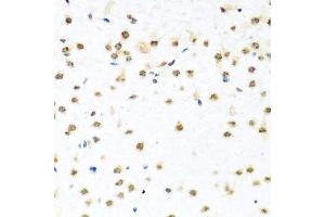 Immunohistochemistry of paraffin-embedded mouse brain using RAB3IP antibody. (RAB3IP Antikörper  (AA 1-150))