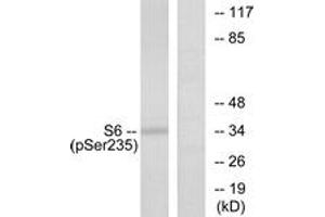 Western blot analysis of extracts from 293 cells treated with serum 10% 15', using S6 Ribosomal Protein (Phospho-Ser235) Antibody. (RPS6 Antikörper  (pSer235))
