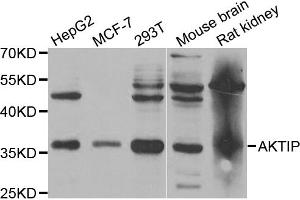 Western blot analysis of extracts of various cell lines, using AKTIP antibody (ABIN5973673) at 1/1000 dilution. (AKTIP Antikörper)