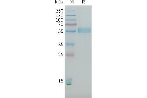 Human R1(21-164 223-359 1097-1246) Protein, His Tag on SDS-PAGE under reducing condition. (PLA2R1 Protein (AA 21-164, AA 223-359, AA 1097-1246) (His tag))