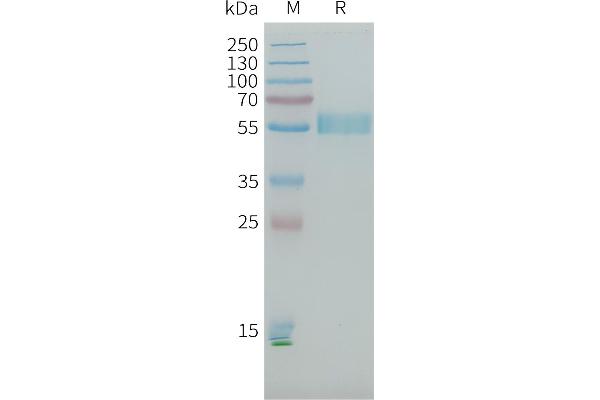 PLA2R1 Protein (AA 21-164, AA 223-359, AA 1097-1246) (His tag)