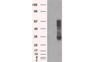 Western Blotting (WB) image for anti-Ring Finger Protein 144B (RNF144B) (AA 1-256) antibody (ABIN1490652) (RNF144B Antikörper  (AA 1-256))