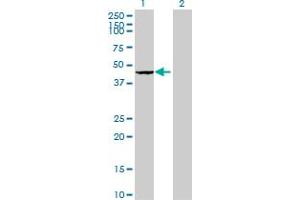 Western Blot analysis of ADAP2 expression in transfected 293T cell line by ADAP2 MaxPab polyclonal antibody. (ADAP2 Antikörper  (AA 1-380))