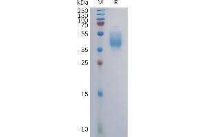 Human Protein, mFc Tag on SDS-PAGE under reducing condition. (GPR87 Protein (AA 1-46) (mFc Tag))
