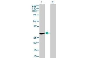 Lane 1: BPHL transfected lysate ( 30. (BPHL 293T Cell Transient Overexpression Lysate(Denatured))