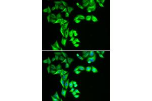 Immunofluorescence analysis of HeLa cells using STRN3 antibody. (STRN3 Antikörper)