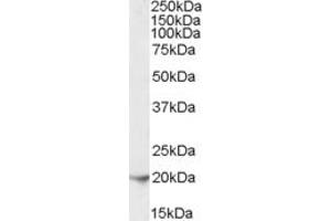 Western Blotting (WB) image for anti-Ferritin, Light Polypeptide (FTL) (C-Term) antibody (ABIN2466622) (FTL Antikörper  (C-Term))