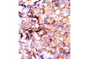 Image no. 2 for anti-Histone 3 (H3) (pSer10) antibody (ABIN358063) (Histone 3 Antikörper  (pSer10))