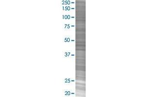 ETS1 transfected lysate. (ETS1 293T Cell Transient Overexpression Lysate(Denatured))