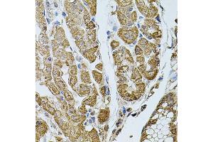 Immunohistochemistry of paraffin-embedded human stomach using CHRFAM7A antibody (ABIN5975203) at dilution of 1/100 (40x lens). (CHRFAM7A Antikörper)