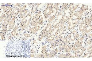 Immunohistochemical analysis of paraffin-embedded human stomach tissue. (Smad2/3 Antikörper)