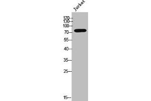 Western Blot analysis of JK cells using Phospho-GRK 2 (S685) Polyclonal Antibody (GRK2 Antikörper  (pSer685))