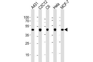 Western Blotting (WB) image for anti-Actin, beta (ACTB) antibody (ABIN658990)