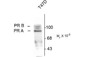 Western blots of whole cell T47D lysate prepared from cells that had been inubated in the presence of the synthetic progestin agonist R5020 (500 nM) showing specific immunolabeling of the ~90k PR-A isoform and the ~120 PR-B isoform of the progesterone receptor phosphorylated at Ser190. (Progesterone Receptor Antikörper  (pSer190))