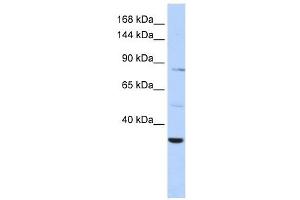 AHNAK2 antibody used at 1 ug/ml to detect target protein. (AHNAK2 Antikörper  (Middle Region))