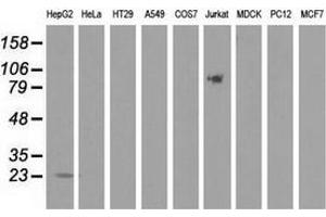 Western blot analysis of extracts (35 µg) from 9 different cell lines by using anti-PEBP1 monoclonal antibody. (PEBP1 Antikörper)