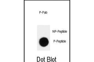 Dot blot analysis of anti-Phospho-p27Kip1- Antibody (ABIN389912 and ABIN2839741) on nitrocellulose membrane. (CDKN1B Antikörper  (pThr198))