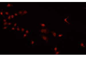 ABIN6269380 staining HeLa cells by IF/ICC. (PDCD4 Antikörper  (C-Term))