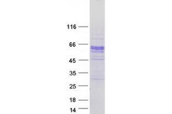 SPOCK2/Testican 2 Protein (Transcript Variant 2) (Myc-DYKDDDDK Tag)