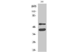 Western Blotting (WB) image for anti-Glycogen Synthase Kinase 3 alpha/beta (GSK3a/b) (Ser4520) antibody (ABIN3175440) (GSK3 alpha/beta Antikörper  (Ser4520))