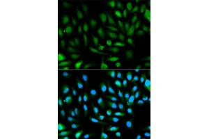 Immunofluorescence analysis of HeLa cells using PARK7 antibody. (PARK7/DJ1 Antikörper)