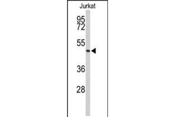 Achaete-scute complex protein T5 (AC) (AA 387-416), (C-Term) Antikörper