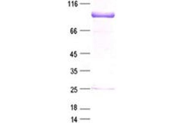 SOX5 Protein (DYKDDDDK Tag)