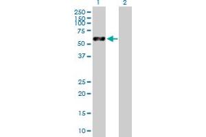 Lane 1: VIM transfected lysate ( 53. (VIM 293T Cell Transient Overexpression Lysate(Denatured))