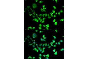 Immunofluorescence analysis of U20S cell using SMC1A antibody. (SMC1A Antikörper)