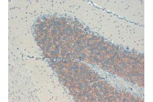 KCHIP Immunohistochemistry. (KCNIP1 Antikörper)