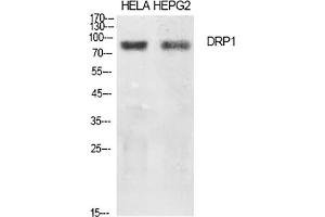 Western Blot analysis of Hela (1), HEPG2 (2), diluted at 1:500. (Dynamin 1-Like Antikörper)