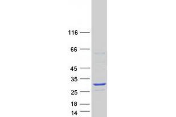 SSX3 Protein (Transcript Variant 1) (Myc-DYKDDDDK Tag)