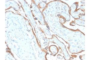 Immunohistochemistry (IHC) image for anti-Epidermal Growth Factor Receptor (EGFR) antibody (ABIN6939297)