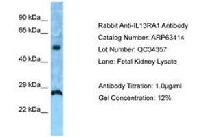 Image no. 1 for anti-Interleukin 13 Receptor, alpha 1 (IL13RA1) (AA 40-89) antibody (ABIN6749982) (IL13 Receptor alpha 1 Antikörper  (AA 40-89))