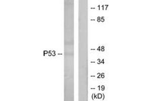 Western blot analysis of extracts from Ovary cancer cells, using p53 (Ab-18) Antibody. (p53 Antikörper  (AA 15-64))