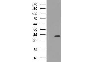 HEK293T cells were transfected with the pCMV6-ENTRY control (Left lane) or pCMV6-ENTRY UCK1 (Right lane) cDNA for 48 hrs and lysed. (UCK1 Antikörper)