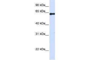 FAM116A antibody used at 1 ug/ml to detect target protein. (FAM116A Antikörper  (Middle Region))