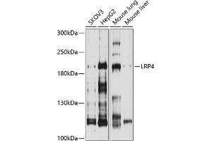 Western blot analysis of extracts of various cell lines, using LRP4 antibody (ABIN6130530, ABIN6143327, ABIN6143328 and ABIN6214330) at 1:1000 dilution. (LRP4 Antikörper  (AA 1500-1725))