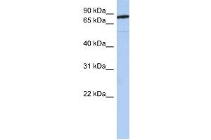 WB Suggested Anti-SEMA4B Antibody Titration:  0. (SEMA4B Antikörper  (N-Term))