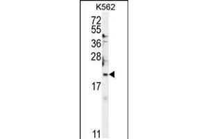 Western blot analysis in K562 cell line lysates (35ug/lane). (BTG2 Antikörper  (N-Term))