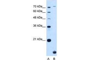 Western Blotting (WB) image for anti-Transmembrane Protein 91 (TMEM91) antibody (ABIN2463996) (TMEM91 Antikörper)